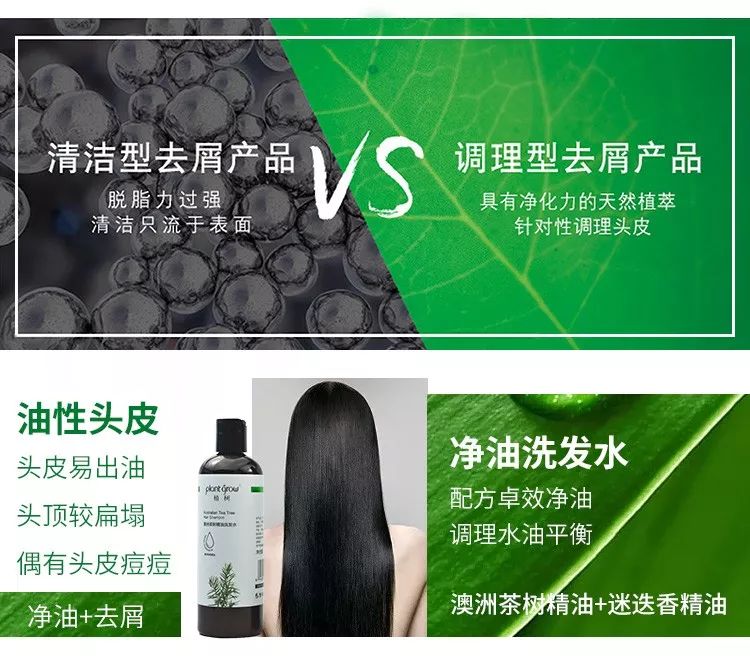 头上又油又有头皮屑又痒怎么办,头上又痒又油有头屑