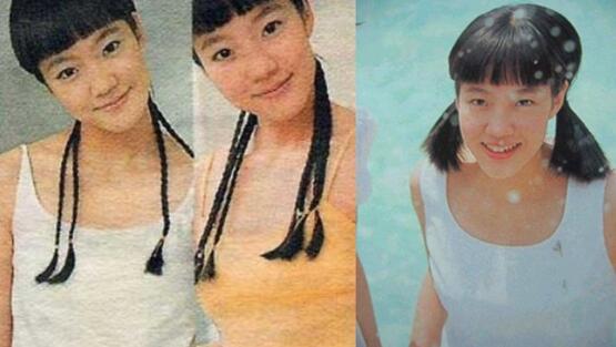 韩国明星谈整容,韩国明星整容失败