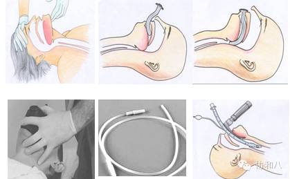 心电图室危重患者抢救流程,手术室危重患者抢救流程