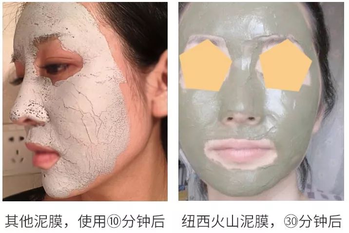 10鍒嗛挓娓呴櫎榛戝ご绮夊埡,榛戝ご绮夊埡鎸ゅ帇娓呯悊姣涘瓟绮楀ぇ