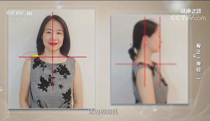 头晕颈椎不舒服是怎么回事,头晕的厉害和颈椎有关系吗