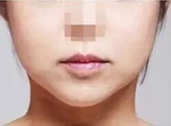 脸胖怎么健身瘦脸,一胖脸就胖怎么锻炼可以瘦脸呢