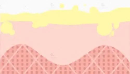 嘴唇干裂起皮等皮掉了涂唇膏,嘴唇干脱皮用什么唇部护理比较好?