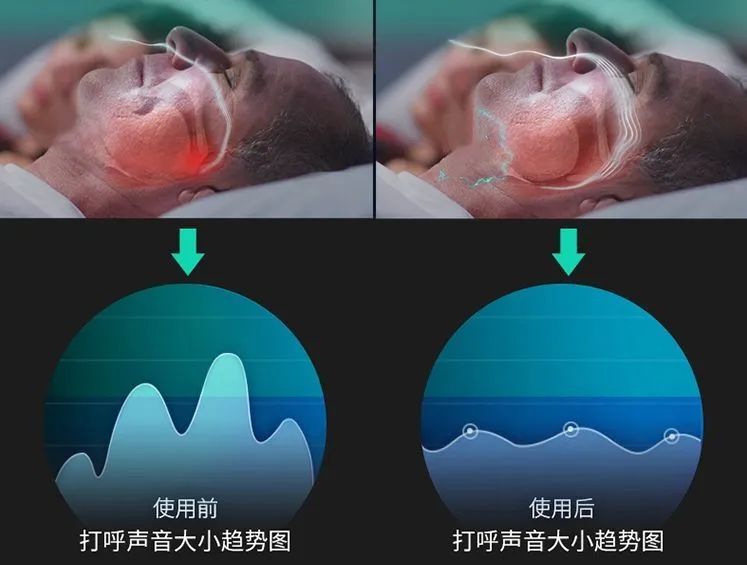 老公呼噜声让我彻夜难眠,老公呼噜声震天响