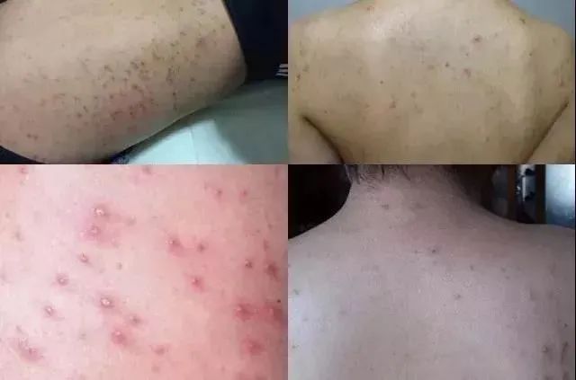 日式碳纤维洗澡巾,日系竹炭搓澡巾