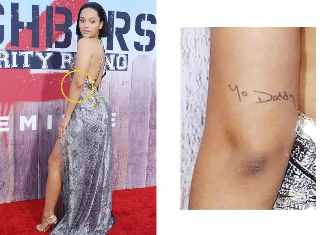 前胸鸡皮痘痘怎么处理,胸背痘痘清理