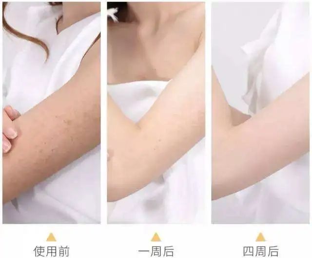 深扒明星美白抗衰秘籍!比防晒管用1000倍!4周逆袭成白皮,悄悄瘦掉8斤