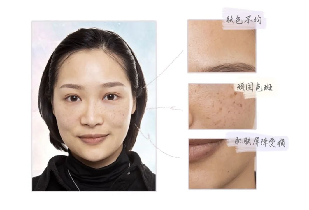 小茂医生护肤品,小茂医生美白护肤品