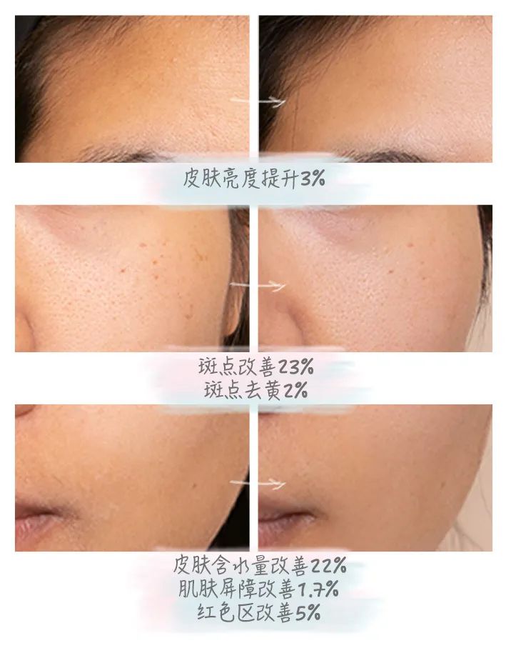 小茂医生护肤品,小茂医生美白护肤品