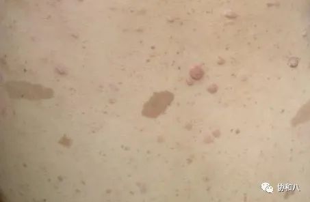 复习这些名解时总觉得怪饿的|协和八·脑洞大开