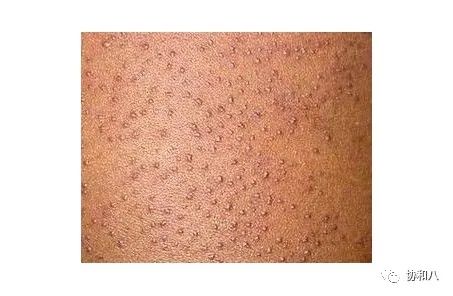 复习这些名解时总觉得怪饿的|协和八·脑洞大开