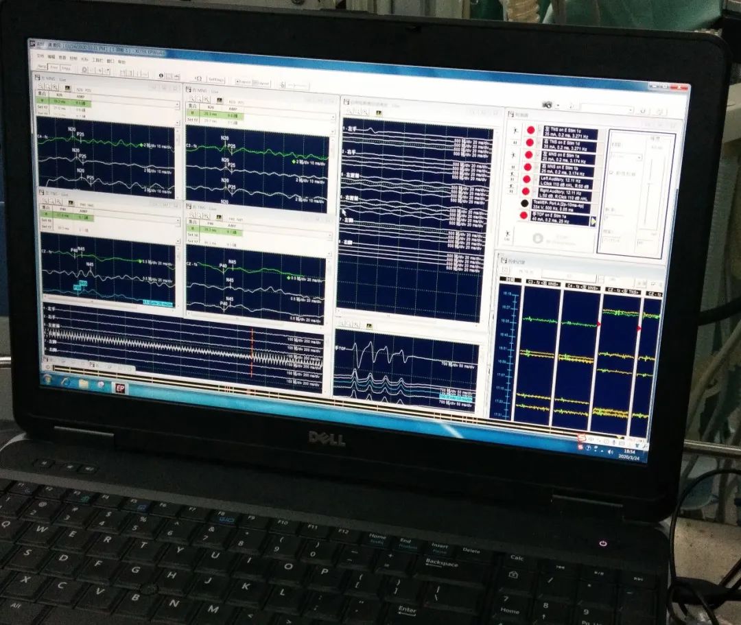中医院脑病科介入手术,市中医院脑病科