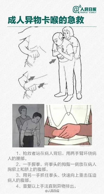 女士长了痔疮,女子得痔疮痛不欲生