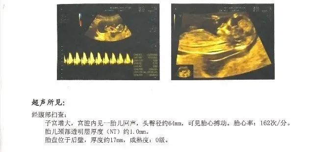 受孕后怎么检测准确率高,受孕后可以做什么检查