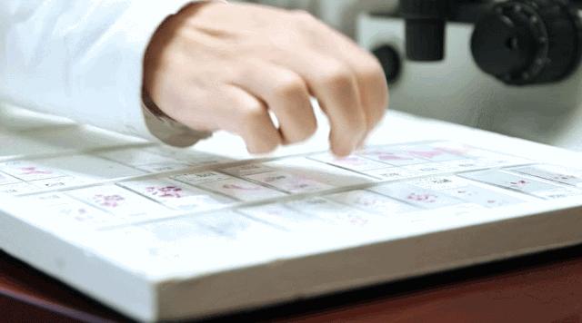 探秘病理科,病理科活检为什么慢