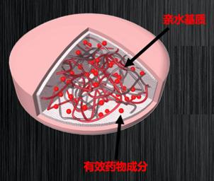 关于心绞痛的西药处方,曲美他嗪治疗心绞痛
