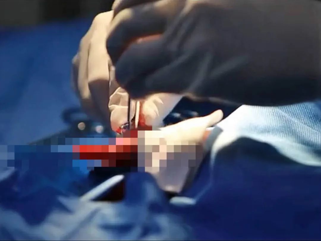 哪怕只有50%的机会,我还会毫不犹豫地跳下去……