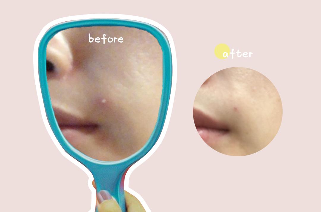 在露肉之前，我要变得白白白！嫩嫩嫩！滑滑滑