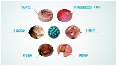 湖南HPV疫苗接种最新公告