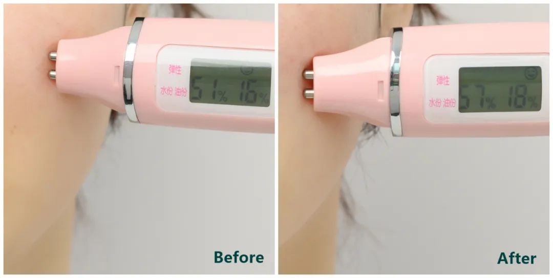 推广一个月没有任何效果,美容院脸部抗衰提拉紧致手法