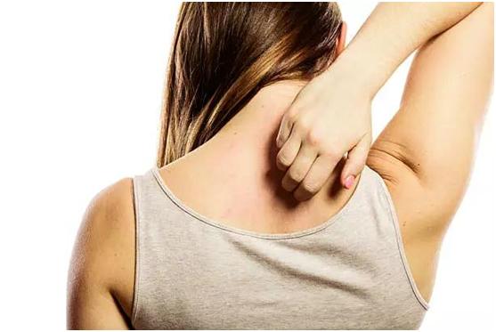 湿疹汗疱疹要注意什么,夏季皮肤湿疹注意事项