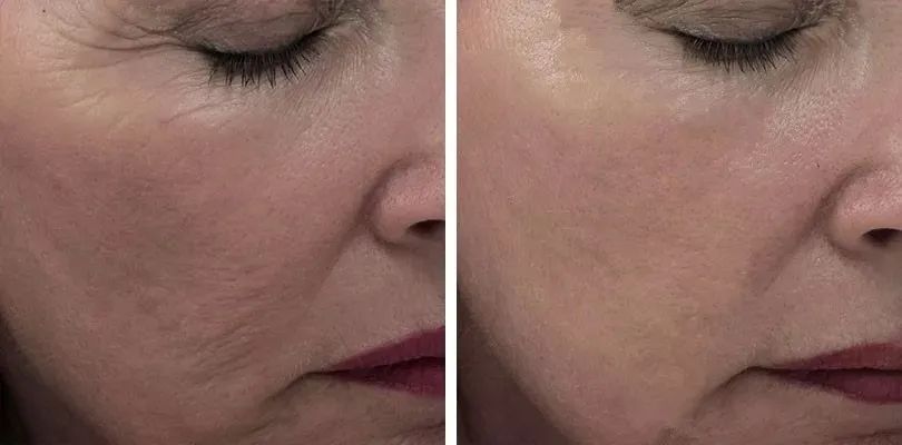 喝胶原蛋白要坚持多久才能有效果,紧急提醒经常喝这个的人要注意了