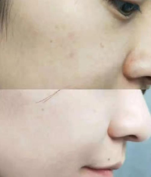 长期补充胶原蛋白的人怎么样了,长期喝胶原蛋白的人最后怎么样了