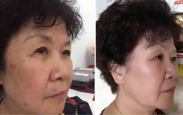 喝胶原蛋白要坚持多久才能有效果,紧急提醒经常喝这个的人要注意了