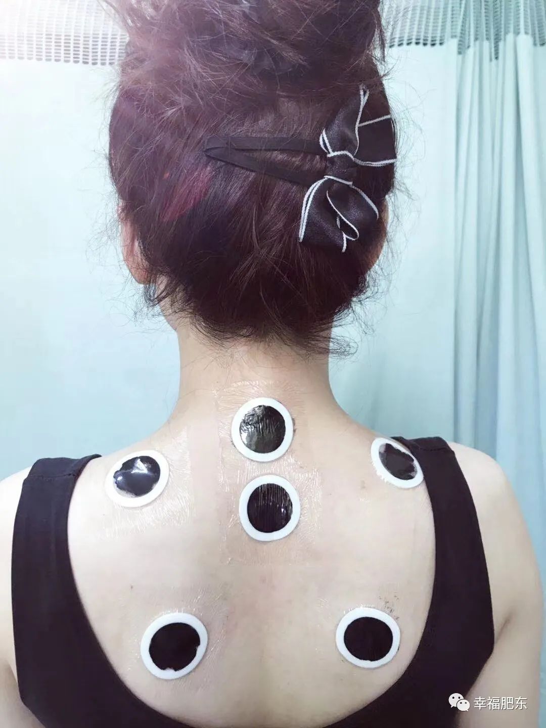 肥东县再添医疗配套,肥东县中医院冬病夏治