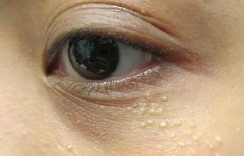 眼霜中的爱马仕!清爽不长脂肪粒,去黑眼圈效果秒2000元腊梅,亲测有效