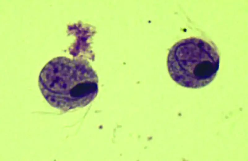 尿液有形成分检查,尿液中检测到的有形成分有哪些