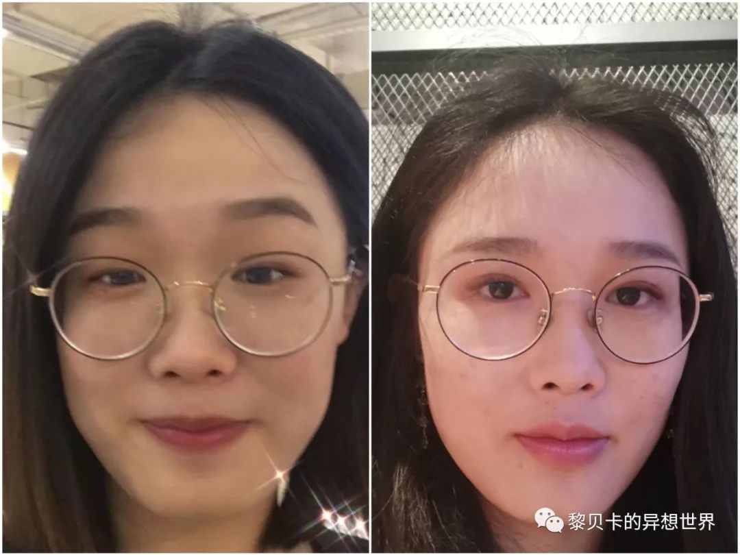 做完医美真的能换脸吗,做完医美需要注意什么