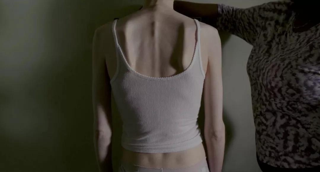 “我23岁，包里装满了纸尿裤”：那些被减肥毁掉的中国女孩们