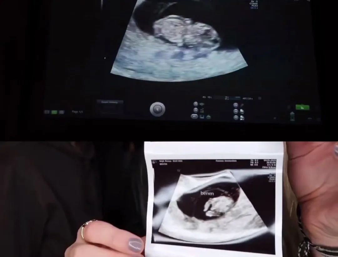 维密天使最新排名,维密天使现在都去哪儿