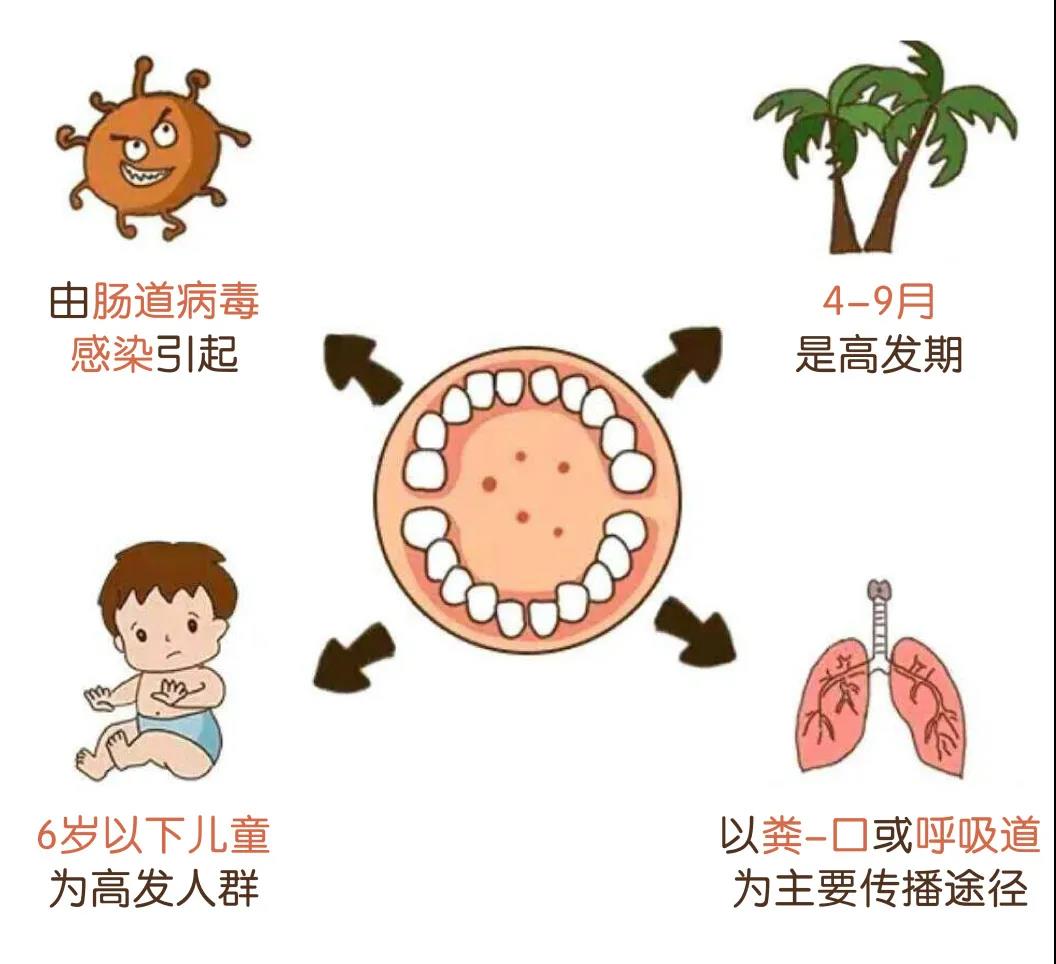 小儿疱疹性咽峡炎要多久好,小儿疱疹性咽峡炎几天可以自愈