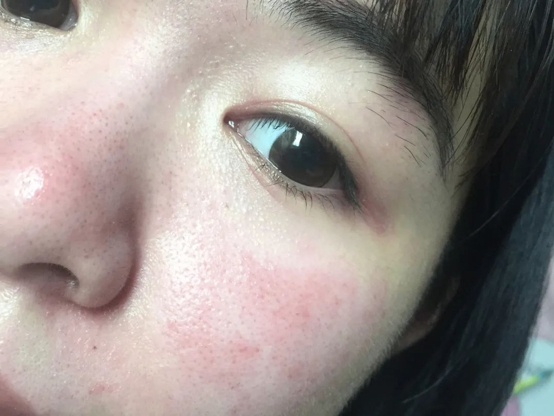 百人测评团|蒸笼天里，想让肌肤“一秒入水”，可能吗？