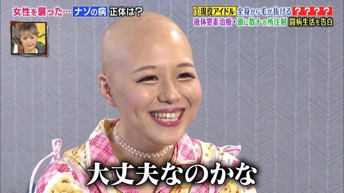 日本16岁美少女偶像歌手脱发到光头！“沦为”假发模特后的她，没有忘记自己甜美的笑容...