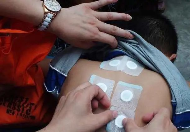 冬病夏治别错过三伏贴趁热贴起来,三伏贴入伏首日冬病夏治进行中