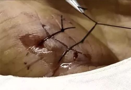 被流浪猫咬到没什么大事吧,不小心被猫咬了一口要打针么