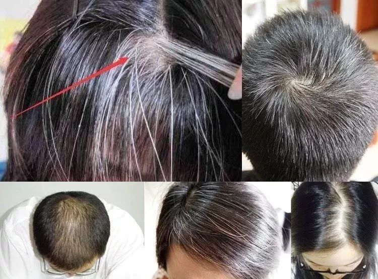 德国旱金莲迷迭香洗发皂,德国何首乌洗发皂