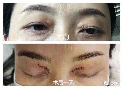 爱美小窍门有哪些,爱美小技巧女生