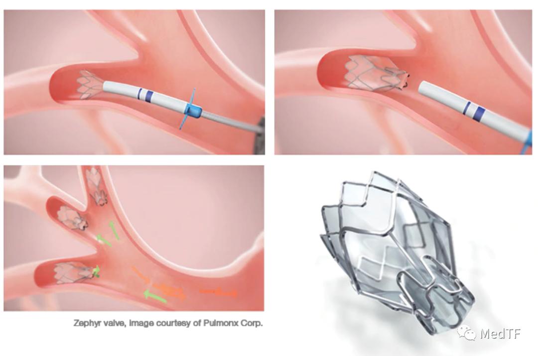 注意这八种药已经停售,注意这8种产品不要买