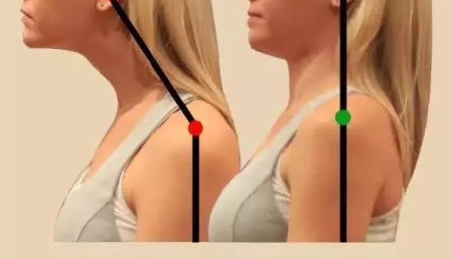 改善含胸驼背的最有效方法10分钟,改善含胸驼背的最有效方法完整版