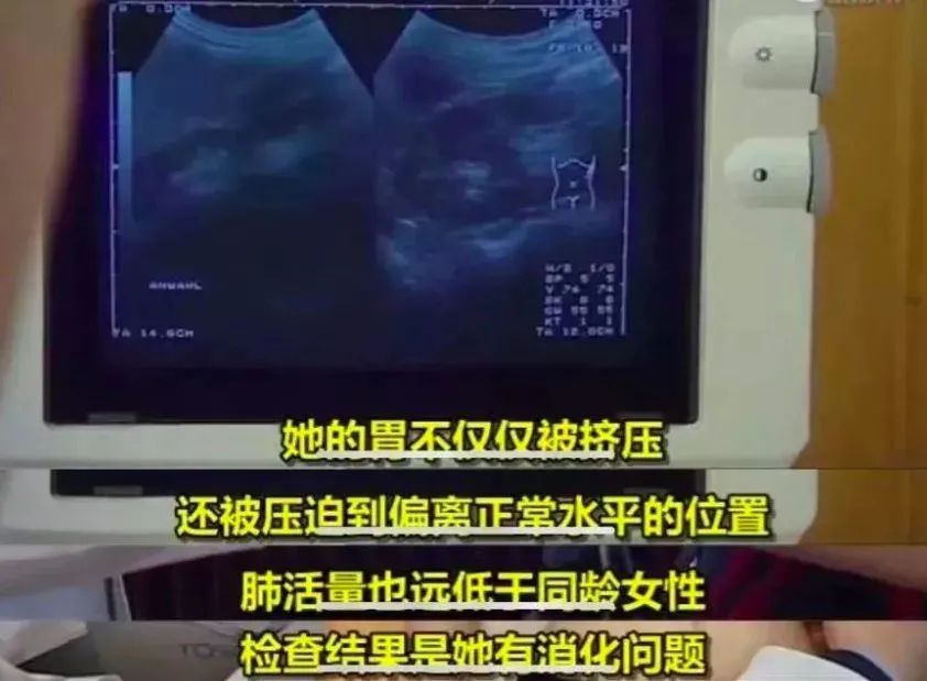 被吹得上天的十种伪健康产品,还有哪些坑人的健康建议