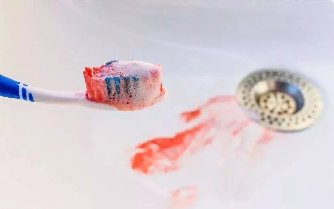 便宜哭了!日本人都在用的变态牙刷,竟然比洗牙还白,牙垢、牙龈出血全解决,嘴巴里脏东西洗出来后,太清爽了