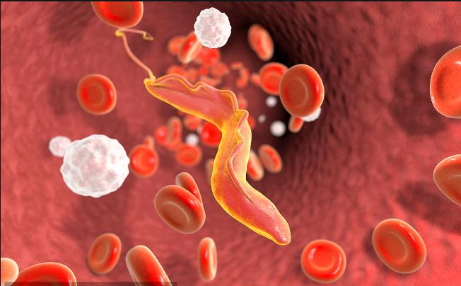 51岁老刘臀部包块不断长大,华山感染专家:是非洲来的“偷渡客”