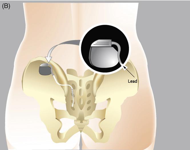 痛如刀绞、生不如死…疼痛部位难以启齿，6年没看好的痛最终在这里得救