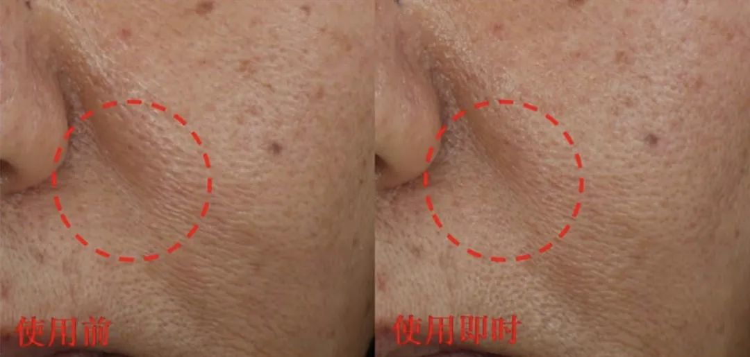 用空瓶回购眼霜,值得空瓶回购的眼霜