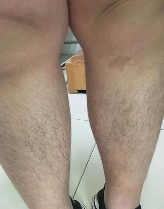 17岁女生长期不来例假怎么回事,15岁女孩3个月不来月经是什么原因