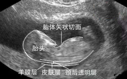 健康一点通怎么查看体检报告,健康孕检单视频